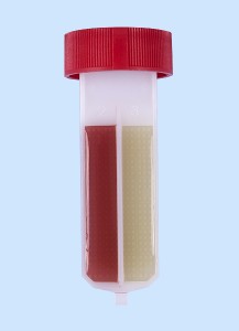 Röhrchen für Keimzahlbestimmung 3-fach, Cled-/MacConkey - Celrimide